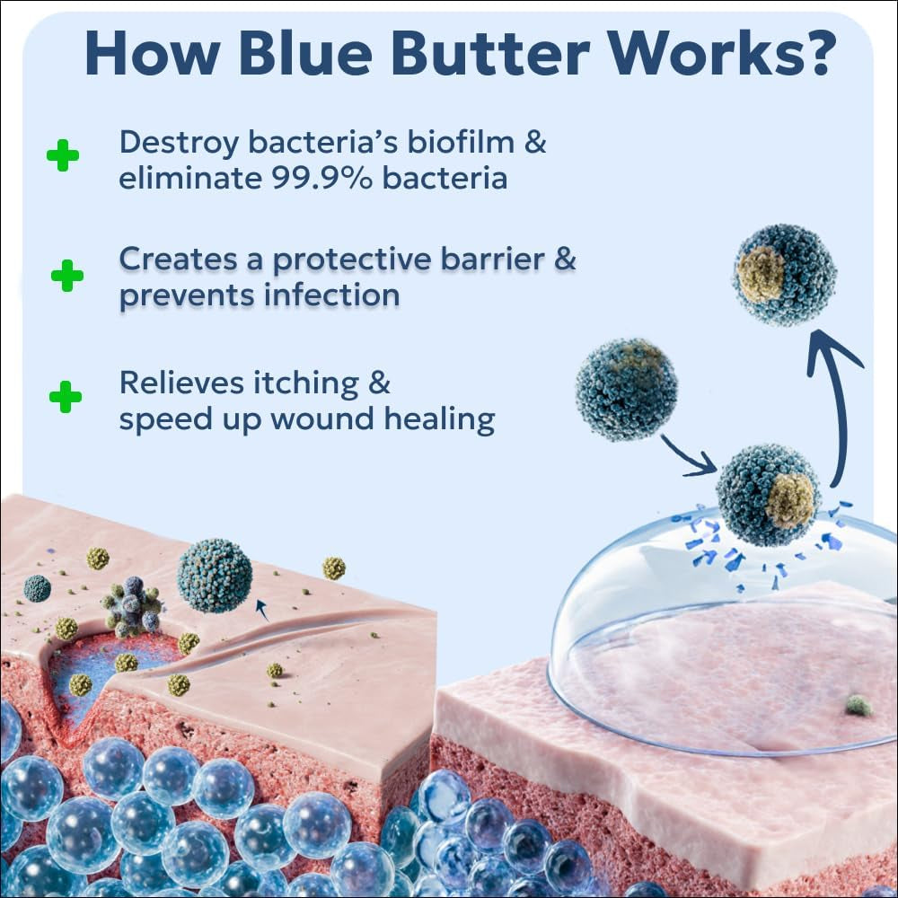 Blue Butter – Hot Spot Treatment for Dogs Cats | Dog Cat Wound Care | Skin Yeast Infections, Ringworm, Cuts, Rashes, First Aid Veterinary Strength anti Itch Cream 4Oz