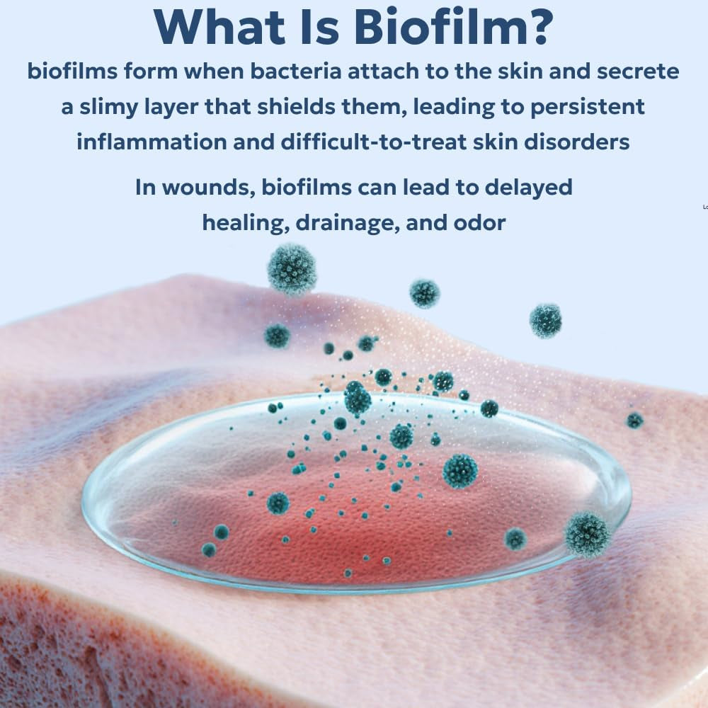 Blue Butter – Hot Spot Treatment for Dogs Cats | Dog Cat Wound Care | Skin Yeast Infections, Ringworm, Cuts, Rashes, First Aid Veterinary Strength anti Itch Cream 4Oz