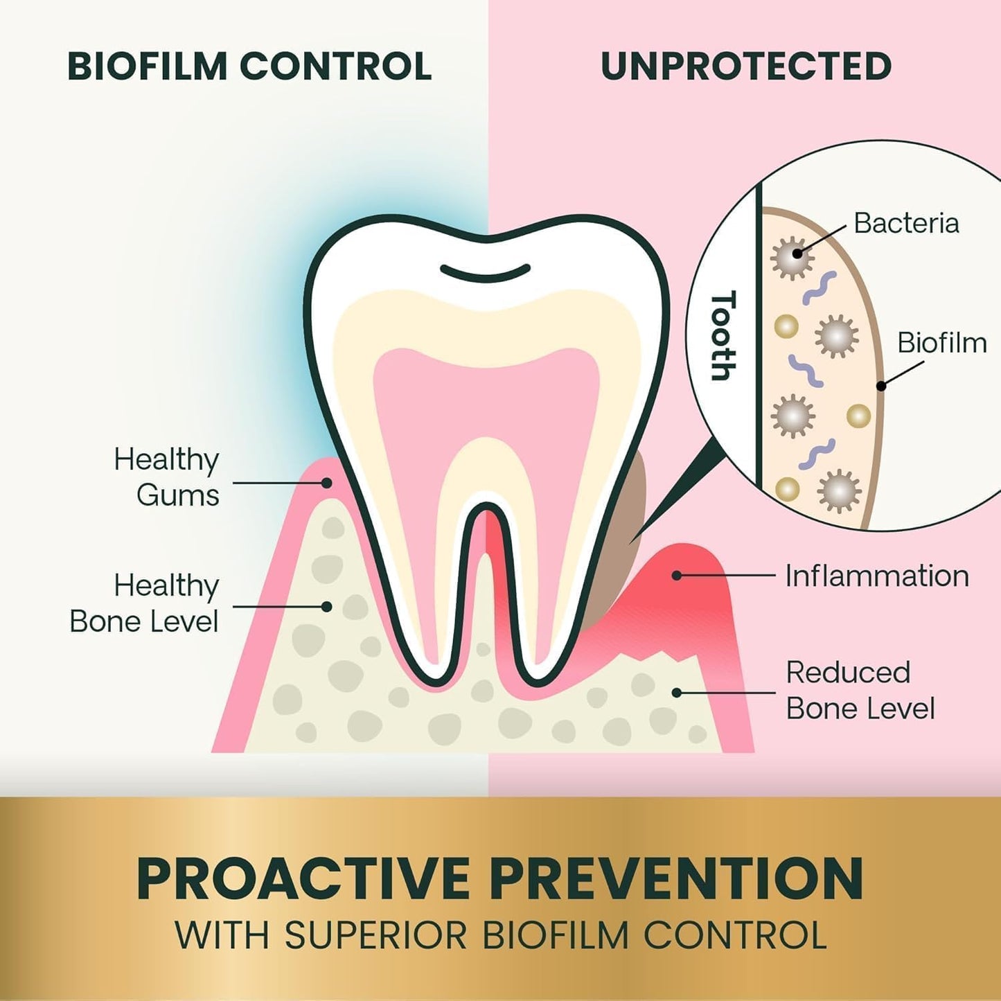 Dental Care Powder, Perio Support Clinically Tested Dental Supplement for Small, Medium and Large Breed Dogs, Freshen Breath, Control Plaque and Tartar, Oral Health, 4.2 Oz